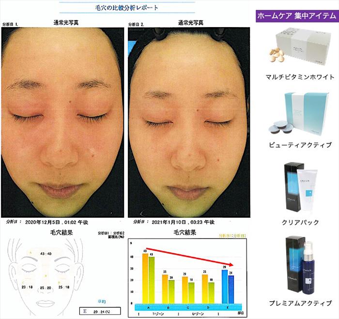 ラティア 1ヶ月ビフォーアフターご紹介
